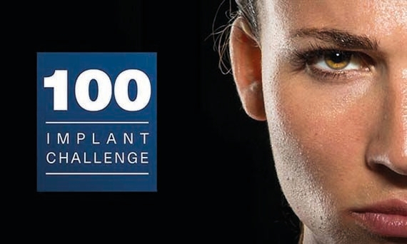 100 Imlant Challege