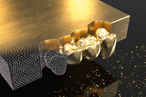 Dental Lab Metal-based Veneering Systems