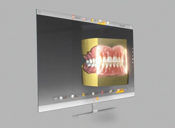 Digital Denture with InLab SW 2.0