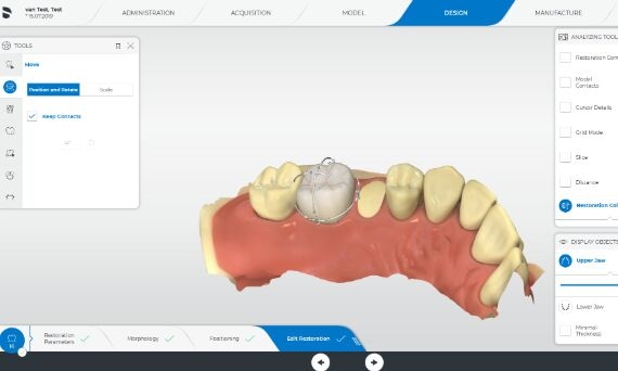 CEREC 5.1 Design Phase, move