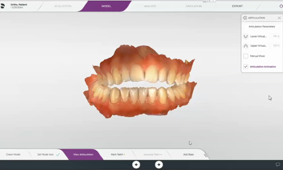 CEREC Ortho SW 2.1 - virtual articulator