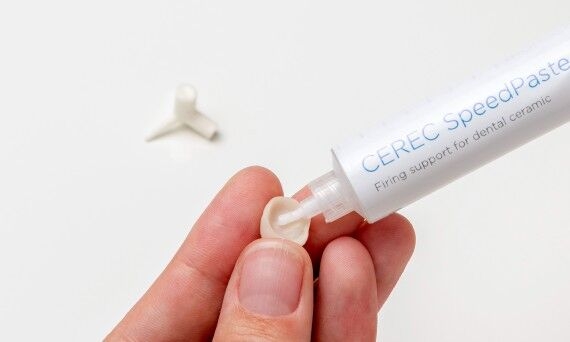 Preparation of the glazing process with CEREC SpeedFire