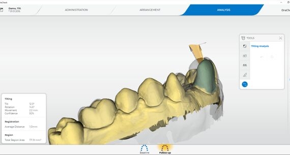 Tilting Analysis, jaw, OraCheck 5