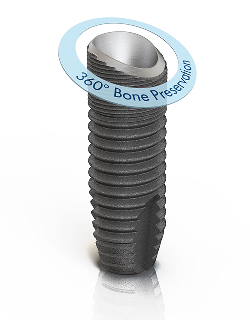 360-Grad-Knochenerhalt dank OsseoSpeed Profile EV-Implantat