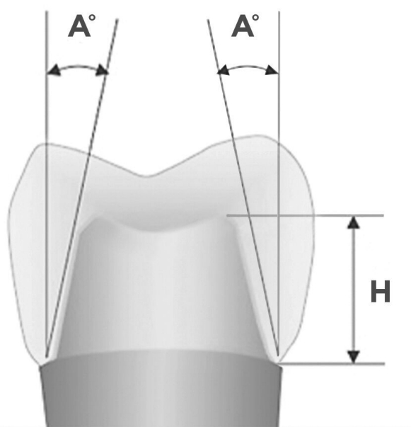 Retentive - Non-retentive diagram