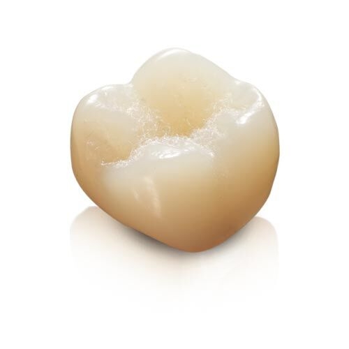Image of a provisional crown from Integrity MultiCure material