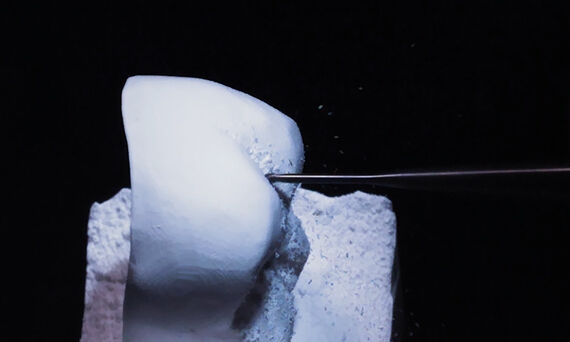 Comparaison de la surface et de l'ajustement des bords du CEREC MC XL et CEREC Primemill