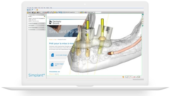 Simplant Pro 18