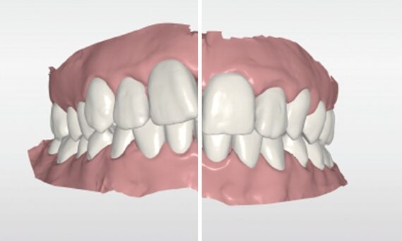 Screenshot CEREC Ortho-software